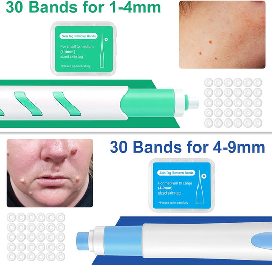 Skin Tag Remover