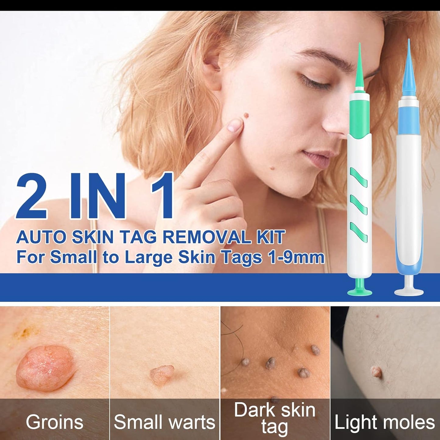 Skin Tag Remover